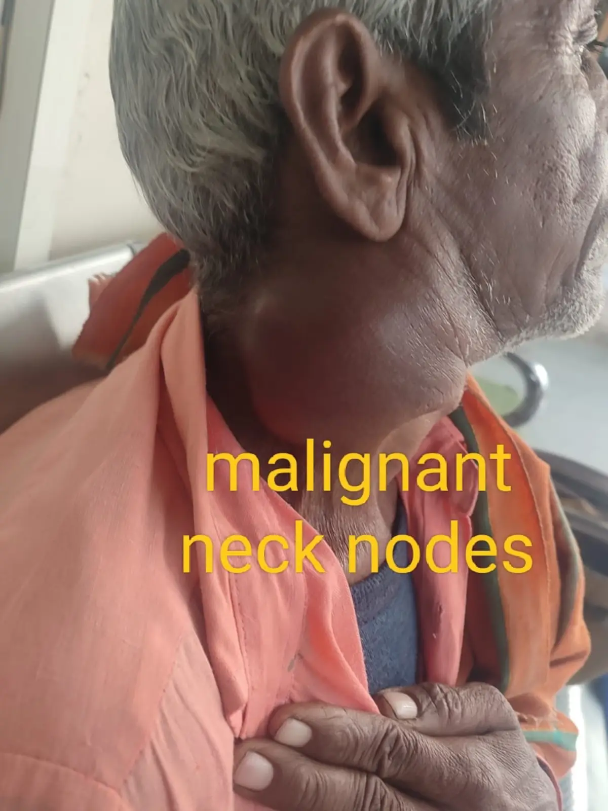 Throat and oral cavity surgical case at Satkriti Hospital