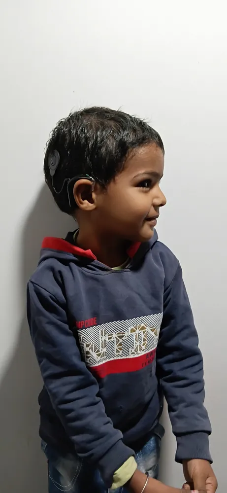 Cochlear Implant care at Satkriti Hospital, Varanasi — photo 2